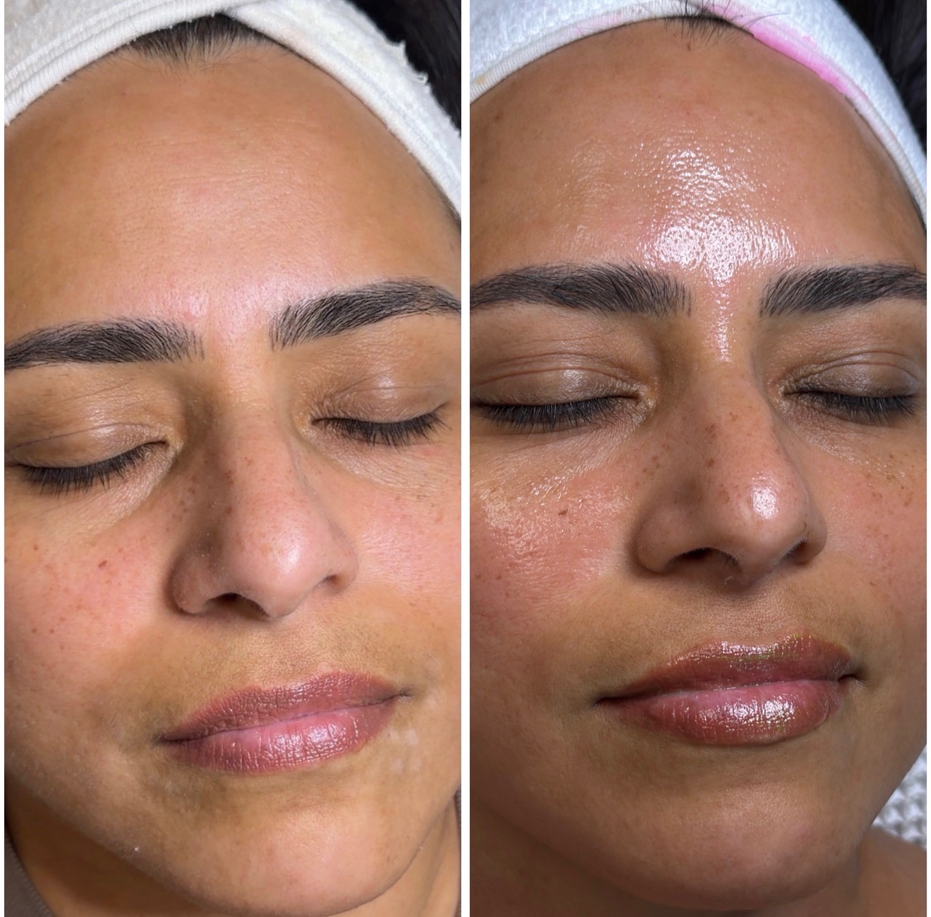 Client glow and skin texture result