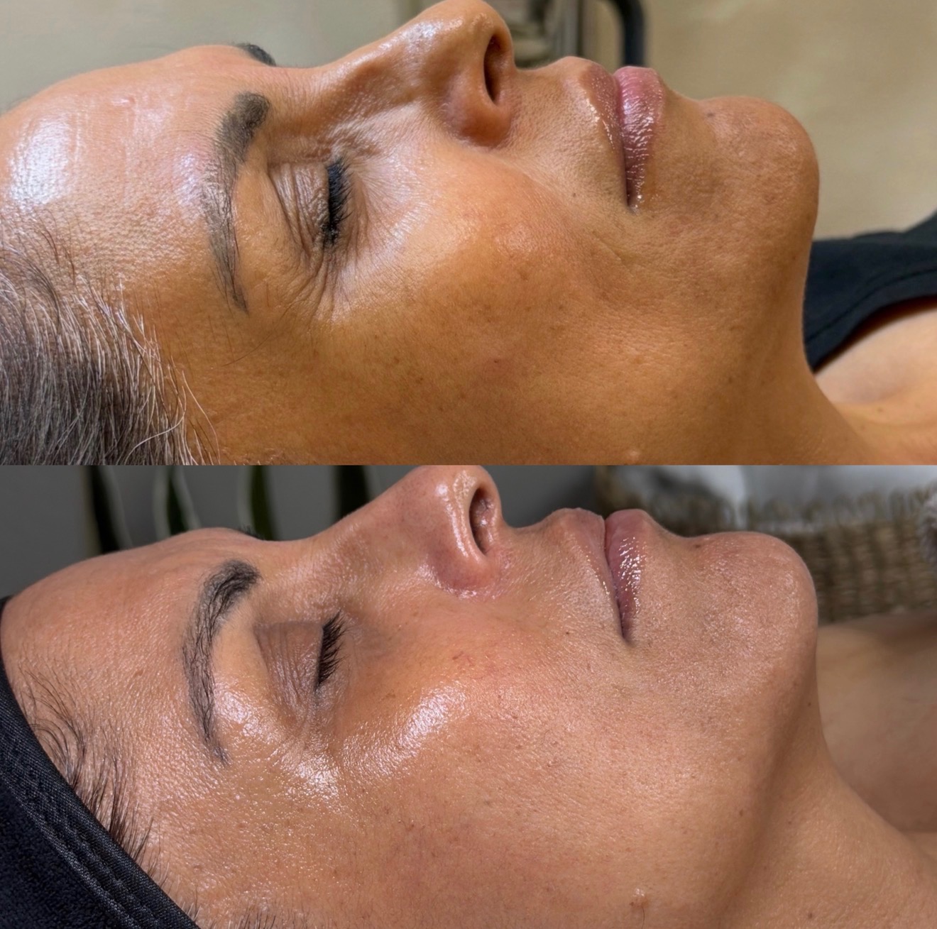 Client hydration and barrier support result